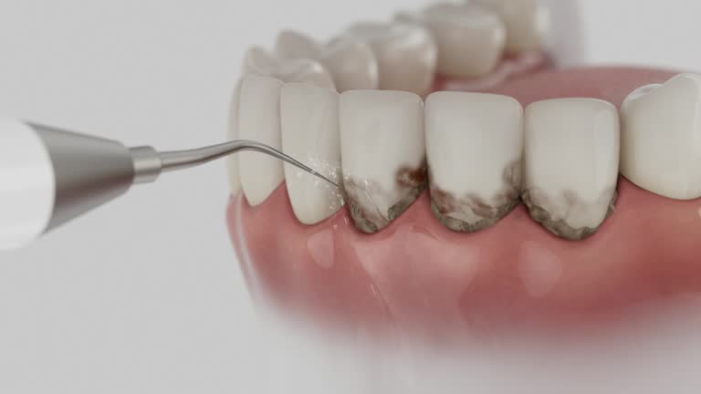 Reliable Dental contractor in Boulder, CO by Smile Center Dentistry